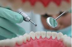 Teeth Drilling