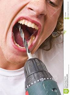 Teeth Drilling