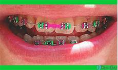 Teeth Used