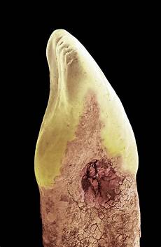 Tooth