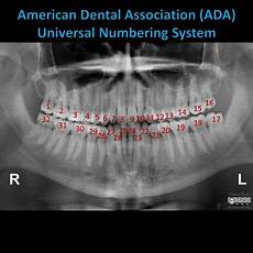 Tooth